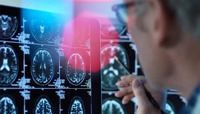 Northland Neurology & Myology advanced analyses Duluth Minnesota Dr David McKee